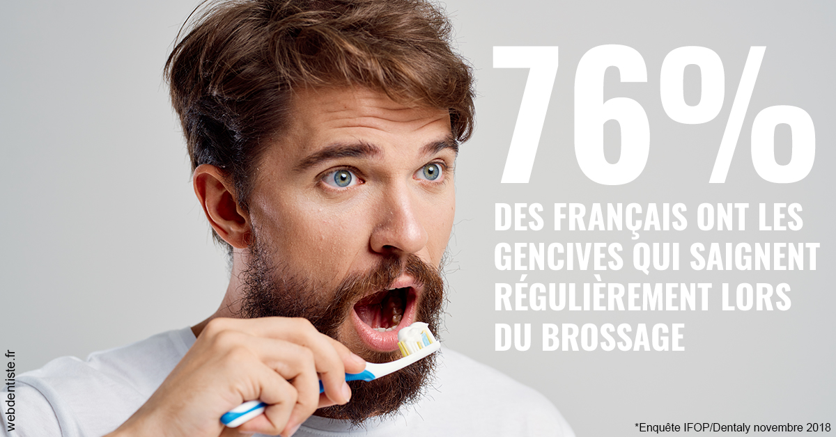 https://www.mysmile-orthodontics.com/76% des Français 2