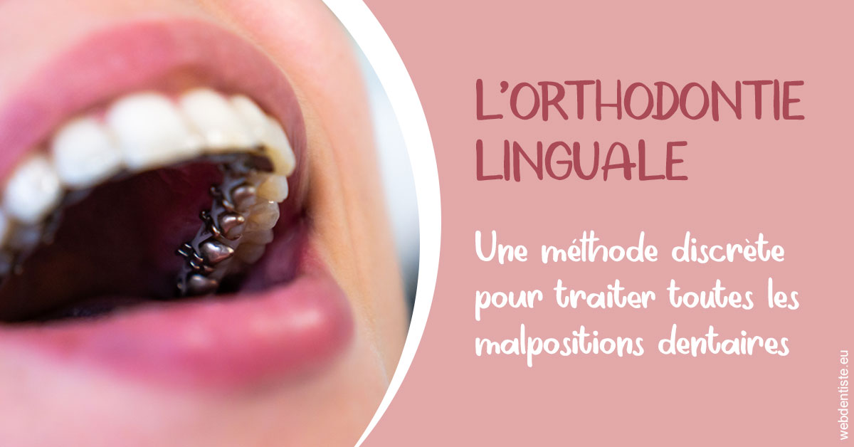 https://www.mysmile-orthodontics.com/L'orthodontie linguale 2