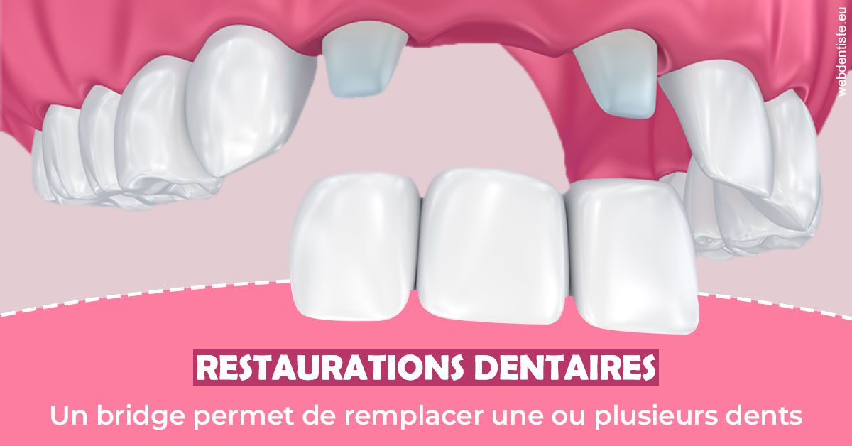https://www.mysmile-orthodontics.com/Bridge remplacer dents 2