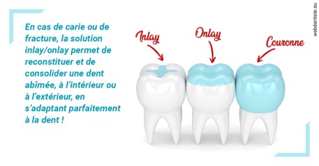 https://www.mysmile-orthodontics.com/L'INLAY ou l'ONLAY