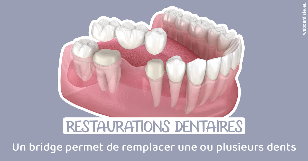 https://www.mysmile-orthodontics.com/Bridge remplacer dents 1