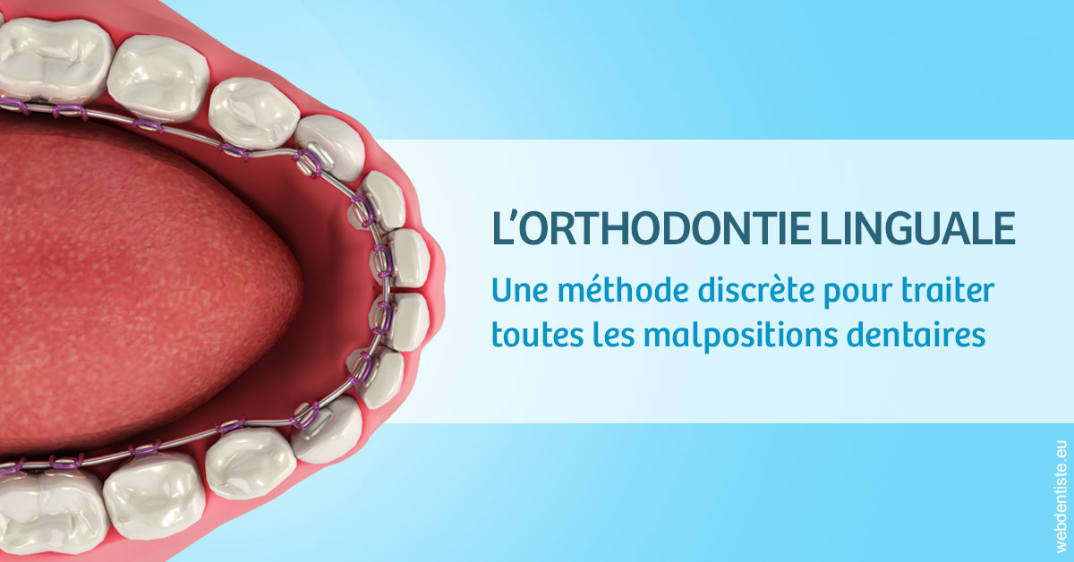 https://www.mysmile-orthodontics.com/L'orthodontie linguale 1
