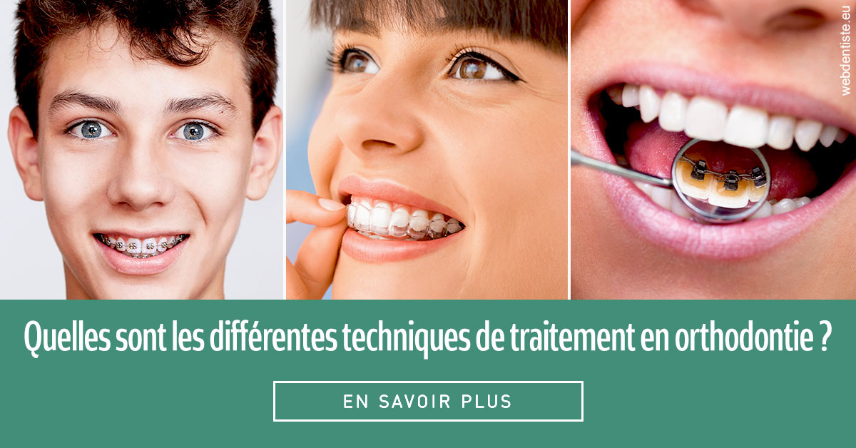 https://www.mysmile-orthodontics.com/Les différentes techniques de traitement 2