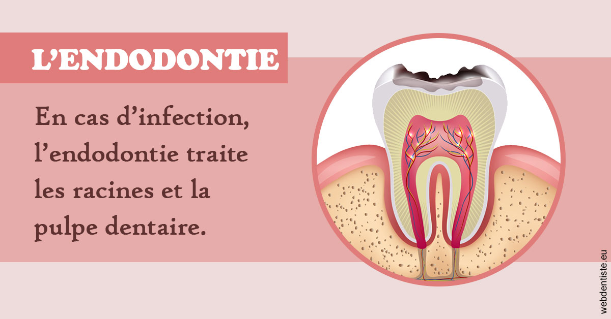 https://www.mysmile-orthodontics.com/L'endodontie 2