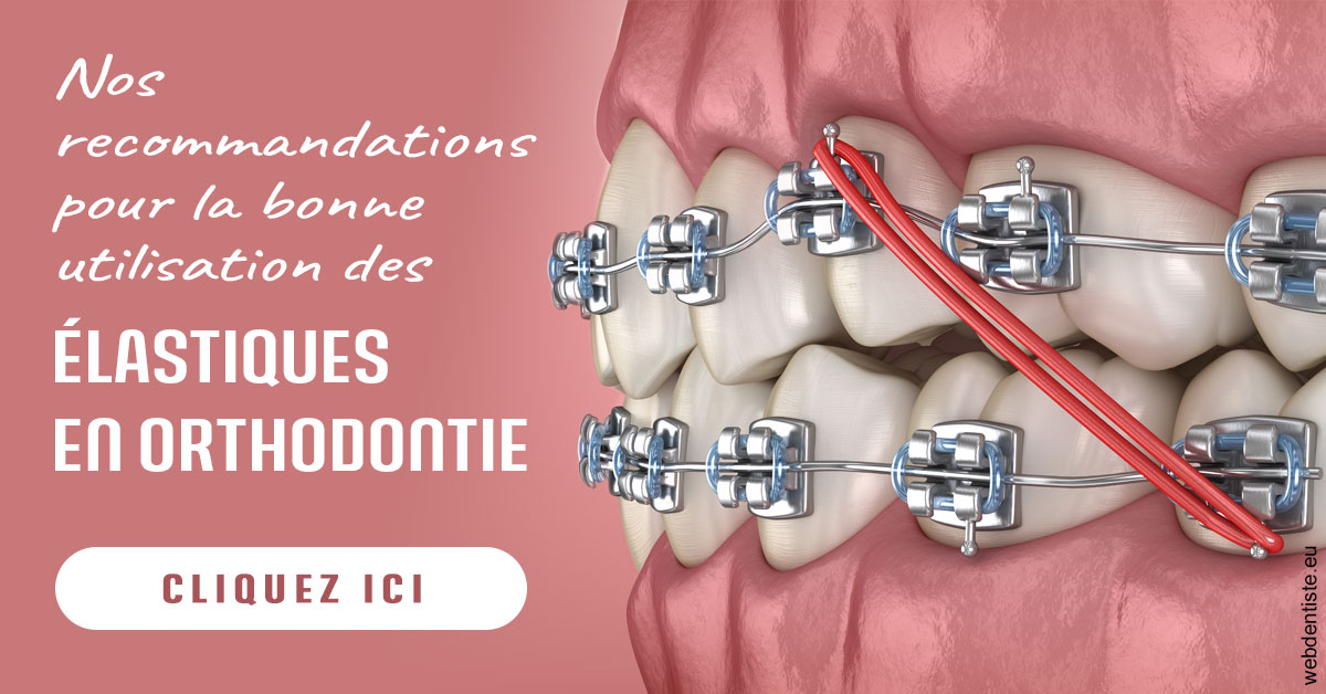 https://www.mysmile-orthodontics.com/Elastiques orthodontie 2